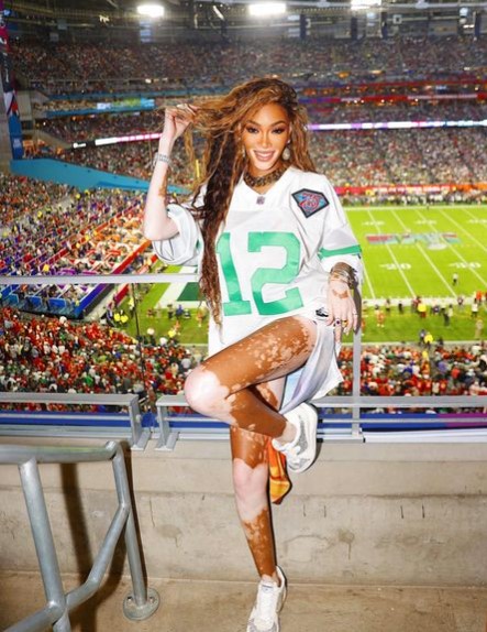 Winnie Harlow poseert tijdens de Super Bowl.